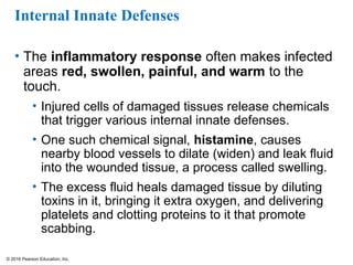 © 2016 Pearson Education, Inc.
Internal Innate Defenses
• The inflammatory response often makes infected
areas red, swollen, painful, and warm to the
touch.
• Injured cells of damaged tissues release chemicals
that trigger various internal innate defenses.
• One such chemical signal, histamine, causes
nearby blood vessels to dilate (widen) and leak fluid
into the wounded tissue, a process called swelling.
• The excess fluid heals damaged tissue by diluting
toxins in it, bringing it extra oxygen, and delivering
platelets and clotting proteins to it that promote
scabbing.
 
