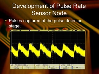 Development of Pulse Rate
Sensor Node
• Pulses captured at the pulse detector
stage.
 