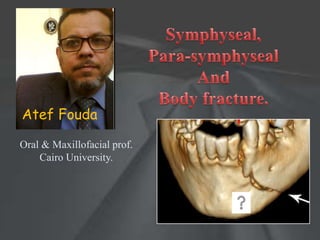 Oral & Maxillofacial prof.
Cairo University.
Atef Fouda
 