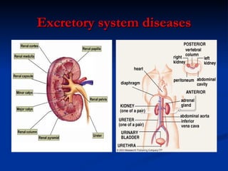 Excretory system diseases 