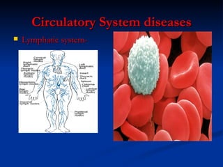 Circulatory System diseases Lymphatic system-  