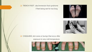  TRENCH FOOT : aka Immersion foot syndrome
if feet being wet for too long
 CHILBLAINS: skin sores or bumps that occur after
exposure to very cold temperature.
 