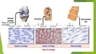 [Type of Hyaline
cartilage]
 