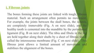 i. Fibrous joints
The bones forming these joints are linked with tough, fibrous
material. Such an arrangement often permits no movement.
For example, the joints between the skull bones, the sutures,
are completely immovable (Fig. A on next slide), and the
healthy tooth is cemented into the mandible by the periodontal
ligament (Fig. B on next slide). The tibia and fibula in the leg
are held together along their shafts by a sheet of fibrous tissue
called the interosseous membrane (Fig. C on next slide) . This
fibrous joint allows a limited amount of movement and
stabilises the alignment of the bones.
 