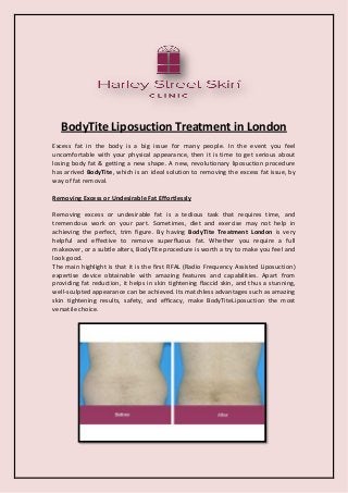 BodyTite Liposuction Treatment in London 
Excess fat in the body is a big issue for many people. In the event you feel uncomfortable with your physical appearance, then it is time to get serious about losing body fat & getting a new shape. A new, revolutionary liposuction procedure has arrived BodyTite, which is an ideal solution to removing the excess fat issue, by way of fat removal. 
Removing Excess or Undesirable Fat Effortlessly 
Removing excess or undesirable fat is a tedious task that requires time, and tremendous work on your part. Sometimes, diet and exercise may not help in achieving the perfect, trim figure. By having BodyTite Treatment London is very helpful and effective to remove superfluous fat. Whether you require a full makeover, or a subtle alters, BodyTite procedure is worth a try to make you feel and look good. 
The main highlight is that it is the first RFAL (Radio Frequency Assisted Liposuction) expertise device obtainable with amazing features and capabilities. Apart from providing fat reduction, it helps in skin tightening flaccid skin, and thus a stunning, well-sculpted appearance can be achieved. Its matchless advantages such as amazing skin tightening results, safety, and efficacy, make BodyTiteLiposuction the most versatile choice. 
 