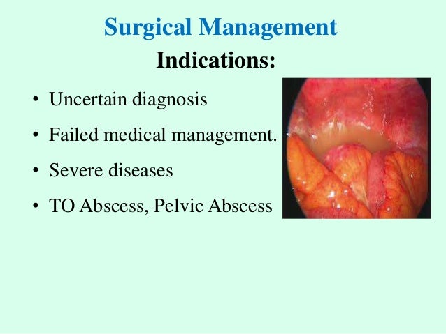 Management Of Pelvic Inflammatory Disease Pid