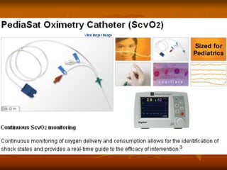 Scvo2 Swan Độ bão hòa oxy máu tĩnh mạch trung tâm - ScvO2 - BS Nguyễn Minh Tiến.ppt