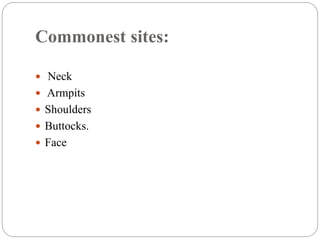 Commonest sites:
 Neck
 Armpits
 Shoulders
 Buttocks.
 Face
 