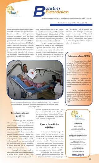 B                        oletim
                                                                         Eletrônico
                                                                  Informativo da Fundação de Apoio à Pesquisa do Distrito Federal - FAPDF


                                                                                                  Brasilia, 01 a 15 de agosto / Ano 2011 / Edição 002



luz de comprimento de onda de aproximada-              ciente, antes e após a aplicação da TFD. A amos-        sam a ser tratados à base de métodos con-
mente 630 nanômetros, que aplicados na área            tra é imediatamente levada para o laboratório de        vencionais como a cirurgia. “Aqueles que
da lesão, desencadeiam reação bioquímica no            Ciências Genômicas e de Biotecnologia da UCB,           reagem bem à aplicação da TFD, além de
organismo provocando a morte das células               onde é feita a extração do RNA (ácido ribonuc-          receberem o benefício da cura, ficam com a
doentes. Sua utilização no Brasil e em outros          léico) e a análise da expressão dos genes envolvi-      pele perfeita e rejuvenescida”, avalia Natália,
países ocorre há vários anos e desde 2009 vem          dos no desenvolvimento do câncer de pele.               ao destacar os ganhos estéticos proporcio-
sendo aplicado em pacientes do HRAN, pela                         “Se após a terapia, o nível da expres-       nados pelo tratamento.
médica e doutoranda Simone Karst Passos, da            são gênica for normal ou nula, é sinal de que
Universidade de Brasília (UnB), sob a orienta-         o paciente está curado,” afirma Rosângela,
ção da professora doutora Zulmira Guerrero             ressaltando que a análise molecular é feita
Marques Lacava, responsável pela coordena-             mediante a confirmação da doença por meio
ção científica dos testes clínicos dessa terapia       de estudos histopatológicos que identificam
e pela avaliação dos efeitos mutagênicos.              o tipo de câncer diagnosticado. “Diante de                  Saiba mais sobre o PPSUS
                                                                                                                              O Programa Gestão Compartilhada
                                                                                                                 em Saúde no DF (PPSUS/DF) é financiado com
                                                                                                                 recursos do Governo Federal (Ministério da Saú-
                                                                                                                 de) e do Governo do Distrito Federal (GDF) com
                                                                                                                 o objetivo de apoiar pesquisas em temas prioritá-
                                                                                                                 rios para a saúde, visando encontrar respostas aos
                                                                                                                 principais problemas do setor que demandam co-
                                                                                                                 nhecimento científico para a sua resolução.

                                                                                                                             O programa é implementado pela
                                                                                                                 FAPDF desde 2004 e de lá para cá foram finan-
                                                                                                                 ciados 37 projetos do total de 155 propostas apre-
                                                                                                                 sentadas envolvendo recursos da ordem de R$ 1,9
                                                                                                                 milhões.

                                                                                                                             No DF o programa visa, principal-
                                                                                                                 mente, fortalecer o Sistema Único de Saúde (SUS)
                                                                                                                 numa parceria que envolve, além do ministério
                                                                                                                 da Saúde, o ministério da Ciência e Tecnologia, o
                                                                                                                 Conselho Nacional de Desenvolvimento Científi-
                                                                                                                 co e Tecnológico (CNPq) e a Secretaria de Saúde
      Momento de preparação da paciente para receber a terapia fotodinâmica. A maca e os aparelhos               do DF.
       MultiWaves e Siberian, utilizados no procedimento, foram financiados com recursos do projeto
                                         financiado pela FAPDF

                                                       qualquer suspeita de recidiva durante a tera-
                                                       pia, o paciente é imediatamente submetido a
       Resultados clínicos                             uma nova avaliação histopatológica.” Segun-
           positivos                                   do Rosângela, até o momento, foram selecio-
                                                       nadas amostras de 40 pacientes.
          Atualmente, por mês, são subme-
tidos ao tratamento no HRAN cerca de 20
(vinte) homens e mulheres, na faixa dos 60                     Cura e benefícios                                                EXPEDIENTE

anos, predominantemente da região do entor-                        estéticos                                                    Boletim da FAPDF
                                                                                                                            Informativo eletrônico da
no do Distrito Federal. Os resultados clínicos                                                                           Fundação de Apoio à Pesquisa do
                                                                                                                                 Distrito Federal
indicam a cura de 80% desses pacientes. Mas                       A mestranda Natália Gurgel do
segundo Rosângela, somente a análise clíni-            Carmo estima que dentro de dois ou três                            Diretor Presidente: Paulo Salles
                                                                                                                     Diretora Técnico-Científica: Regina Buani
ca não é suficiente. “Percebemos que clinica           meses sejam concluídas as análises das                        Diretor Administrativo: Tarcísio Sant’Anna

mente o paciente tem uma melhora conside-              amostras de aproximadamente 15 dos
                                                                                                                       Jornalista responsável: Célia Chaves
rável, mas isto pode estar mascarando a lesão”,        pacientes estudados. “São muitas amostras                             Reg.Prof. 1044 – DRT/PA
                                                                                                                        Colaboração e fotos: Elias Suaiden
diz, justificando, dessa forma, a necessidade          e para estudar a expressão gênica temos que
                                                                                                                       Editoração eletrônica: Marúcia Costa
da análise molecular para a comprovação                comparar a expressão dos mesmos genes em
                                                                                                                               SIA Trecho 6, lote 105
científica do resultado clínico.                       uma célula normal com a alterada para saber-                         Fones: (61) 3462 8800/8881
          Rosângela informa que o estudo co-           mos como os genes estão se comportando”.                              Email: fapdf@fap.df.gov.br
                                                                                                                            CEP: 71205 060 – Brasília-DF
meça com a seleção prévia das lesões seguida                      Segundo ela, dos 40 pacientes sele-
da retirada de uma amostra do tumor e uma              cionados apenas dois não responderam bem                            Acesse o nosso site
                                                                                                                           www.fap.df.gov.br
amostra controle (pele normal) de cada pa-             ao tratamento. Pacientes nesta situação pas-
                                                                                                                                                                  02
 