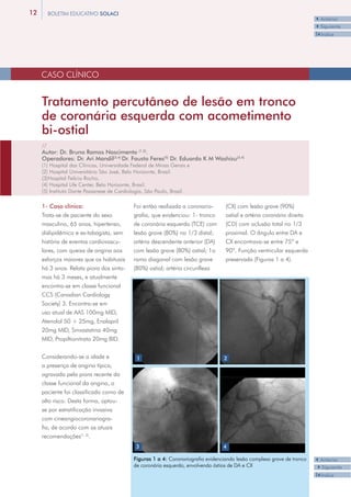 12     BOLETIM EDUCATIVO SOLACI
                                                                                                                          3Anterior
                                                                                                                          4Siguiente
                                                                                                                          I3Indice




     CASO CLÍNICO


     Tratamento percutâneo de lesão em tronco
     de coronária esquerda com acometimento
     bi-ostial
     //
     Autor: Dr. Bruno Ramos Nascimento (1,2).
     Operadores: Dr. Ari Mandil(3,4) Dr. Fausto Feres(5) Dr. Eduardo K M Washizu(3,4)
     (1) Hospital das Clínicas, Universidade Federal de Minas Gerais e
     (2) Hospital Universitário São José, Belo Horizonte, Brasil.
     (3)Hospital Felício Rocho,
     (4) Hospital Life Center, Belo Horizonte, Brasil.
     (5) Instituto Dante Pazzanese de Cardiologia, São Paulo, Brasil.

     1- Caso clínico:                        Foi então realizada a coronario-       (CX) com lesão grave (90%)
     Trata-se de paciente do sexo            grafia, que evidenciou: 1- tronco      ostial e artéria coronária direita
     masculino, 65 anos, hipertenso,         de coronária esquerda (TCE) com        (CD) com oclusão total no 1/3
     dislipidêmico e ex-tabagista, sem       lesão grave (80%) no 1/3 distal;       proximal. O ângulo entre DA e
     história de eventos cardiovascu-        artéria descendente anterior (DA)      CX encontrava-se entre 75º e
     lares, com queixa de angina aos         com lesão grave (80%) ostial; 1o       90º. Função ventricular esquerda
     esforços maiores que os habituais       ramo diagonal com lesão grave          preservada (Figuras 1 a 4).
     há 3 anos. Relata piora dos sinto-      (80%) ostial; artéria circunflexa
     mas há 3 meses, e atualmente
     encontra-se em classe funcional
     CCS (Canadian Cardiology
     Society) 3. Encontra-se em
     uso atual de AAS 100mg MID,
     Atenolol 50 + 25mg, Enalapril
     20mg MID, Sinvastatina 40mg
     MID, Propiltionitrato 20mg BID.


     Considerando-se a idade e                1                                    2
     a presença de angina típica,
     agravada pela piora recente da
     classe funcional da angina, o
     paciente foi classificado como de
     alto risco. Desta forma, optou-
     se por estratificação invasiva
     com cineangiocoronariogra-
     fia, de acordo com as atuais
     recomendações(1, 2).
                                              3                                    4

                                             Figuras 1 a 4: Coronariografia evidenciando lesão complexa grave de tronco   3Anterior
                                             de coronária esquerda, envolvendo óstios de DA e CX                          4Siguiente
                                                                                                                          I3Indice
 