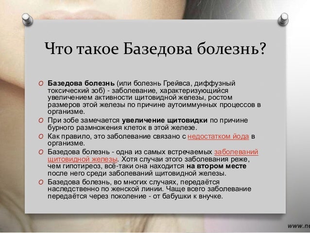 Базедова болезнь: причины, симптомы, диагностика и лечение