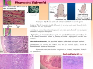 Diagnosticul Diferential 
Depletia Placilor Payer 
 