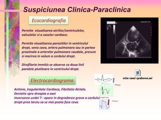 Suspiciunea Clinica-Paraclinica 
Ecocardiografia 
Permite vizualizarea atriilor/ventriculelor, 
valvulelor si a vaselor cardiace. 
Permite vizualizarea parazitilor in ventriculul 
drept, vena cava, artera pulmonara sau in partea 
proximala a arterelor pulmonare caudale, precum 
si marirea in volum a cordului drept. 
Dirofilaria immitis se observa ca doua linii 
paralele plutitoare in ventriculul drept. 
Electrocardiograma 
Aritmie, Iregularitate Cardiaca, Fibrilatie Atriala. 
Deviatie spre dreapta a axei 
Inversarea undei T : apare in degradarea grava a cordului 
drept-prea tarziu sa se mai poata face ceva 
 