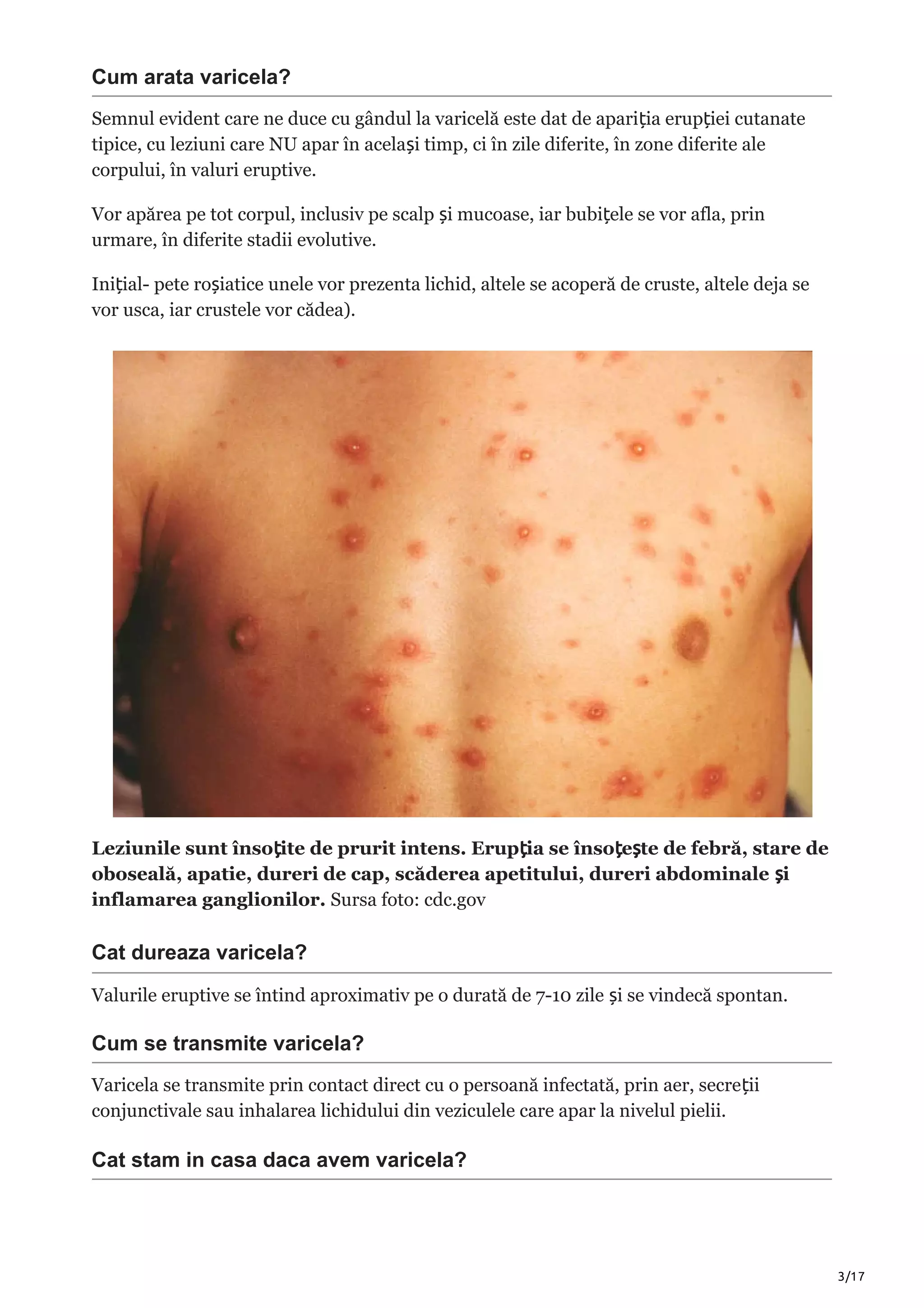 Care sunt bolile copilariei si cum se trateaza | alternamed.ro