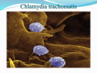 Chlamydia trachomatis
 