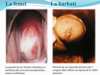 La femei La barbati
Pacientii de sex masculin pot dezvolta o
scurgere alba, tulbure sau apoasa de la vârful
penisului.
La pacintii de sex feminin clamidioza se
manifesta prin cervicita mucopurulenta ,
eritem si inflamatie.
 
