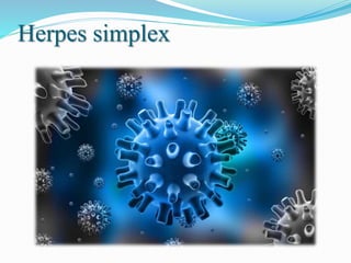 Herpes simplex
 