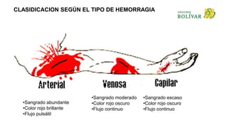 CLASIDICACION SEGÚN EL TIPO DE HEMORRAGIA
•Sangrado abundante
•Color rojo brillante
•Flujo pulsátil
•Sangrado moderado
•Color rojo oscuro
•Flujo continuo
•Sangrado escaso
•Color rojo oscuro
•Flujo continuo
 