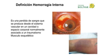Definición Hemorragia Interna
Es una perdida de sangre que
se produce desde el sistema
vascular en un cavidad o
espacio corporal normalmente
asociado a un traumatismo
Musculo esquelético
 