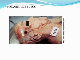  POR ARMA DE FUEGO
 