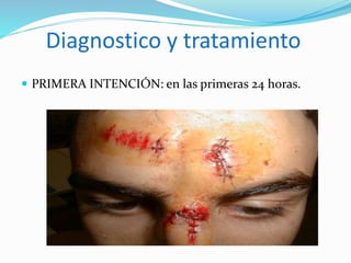 Diagnostico y tratamiento
 PRIMERA INTENCIÓN: en las primeras 24 horas.
 
