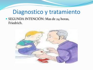 Diagnostico y tratamiento
 SEGUNDA INTENCIÓN: Mas de 24 horas,
Friedrich.
 