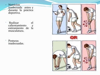 – Nutricion
inadecuada antes y
durante la práctica
deportiva.
⁻ Realizar el
calientamiento y
estiramiento de la
musculatura.
⁻ Posturas
inadecuadas.
 