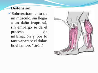 Distensiòn:
 Sobreestiramiento de
un mùsculo, sin llegar
a un daño (ruptura),
sin embargo se da el
proceso de
inflamación y por lo
tanto aparece el dolor.
Es el famoso “tiròn”.
 