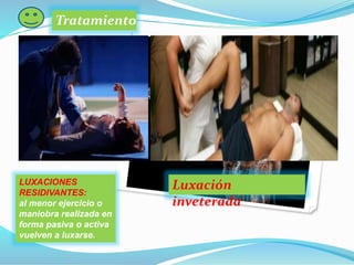 Tratamiento :
LUXACIONES
RESIDIVANTES:
al menor ejercicio o
maniobra realizada en
forma pasiva o activa
vuelven a luxarse.
Luxación
inveterada
 