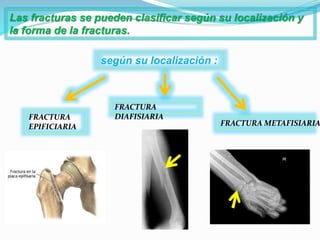 Las fracturas se pueden clasificar según su localización y
la forma de la fracturas.
según su localización :
FRACTURA
EPIFICIARIA
FRACTURA
DIAFISIARIA
FRACTURA METAFISIARIA
 