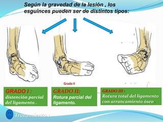 Según la gravedad de la lesión , los
esguinces pueden ser de distintos tipos:
GRADO I :
distención parcial
del ligamento .
GRADO II:
Rotura parcial del
ligamento.
GRADO III :
Rotura total del ligamento
con arrancamiento óseo .
Tratamiento :
 