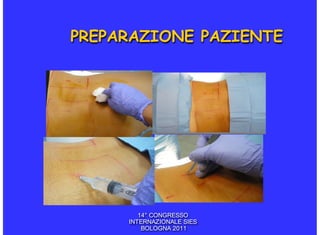 PREPARAZIONE PAZIENTE




        14° CONGRESSO
     INTERNAZIONALE SIES
         BOLOGNA 2011
 