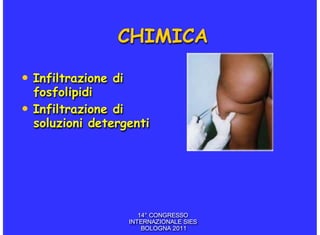 CHIMICA

• Infiltrazione di
  fosfolipidi
• Infiltrazione di
  soluzioni detergenti




                        14° CONGRESSO
                     INTERNAZIONALE SIES
                         BOLOGNA 2011
 
