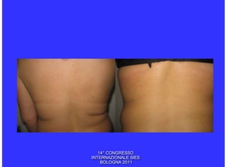 14° CONGRESSO
INTERNAZIONALE SIES
    BOLOGNA 2011
 