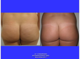 14° CONGRESSO
INTERNAZIONALE SIES
    BOLOGNA 2011
 