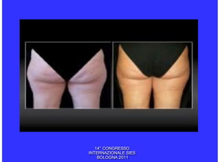 14° CONGRESSO
INTERNAZIONALE SIES
    BOLOGNA 2011
 
