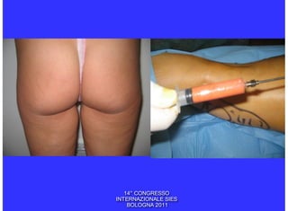 14° CONGRESSO
INTERNAZIONALE SIES
    BOLOGNA 2011
 