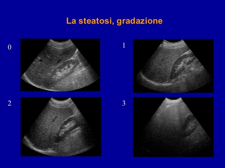 Diagnostica per immagini nelle epatopatie croniche