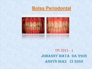 Bolsa Periodontal



Bolsa periodontal


           TPI 2011 - 1
     Johanny mata da 9908
       Annys Diaz ci 3268
 