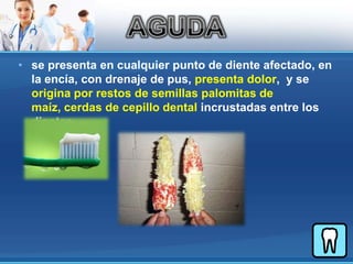 se presenta en cualquier punto de diente afectado, en la encía, con drenaje de pus, presenta dolor,  y se origina por restos de semillas palomitas de maíz, cerdas de cepillo dental incrustadas entre los dientes.AGUDA