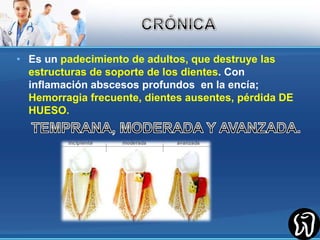 CRÓNICAEs un padecimiento de adultos, que destruye las estructuras de soporte de los dientes. Con inflamación abscesos profundos  en la encía; Hemorragia frecuente, dientes ausentes, pérdida DE HUESO.TEMPRANA, MODERADA Y AVANZADA.