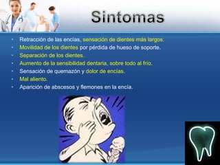 Retracción de las encías, sensación de dientes más largos.Movilidad de los dientes por pérdida de hueso de soporte.Separación de los dientes.Aumento de la sensibilidad dentaria, sobre todo al frío.Sensación de quemazón y dolor de encías.Mal aliento.Aparición de abscesos y flemones en la encía.Sintomas