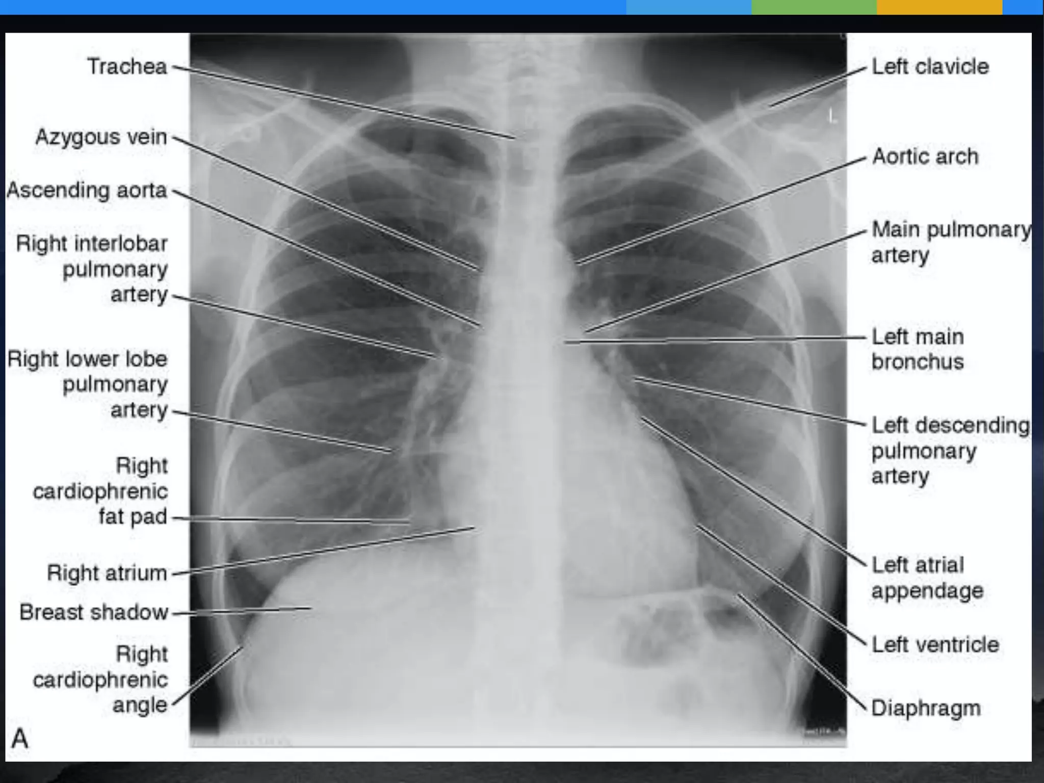 diagnostic workup of the the thoracic surgery patient | PPTX