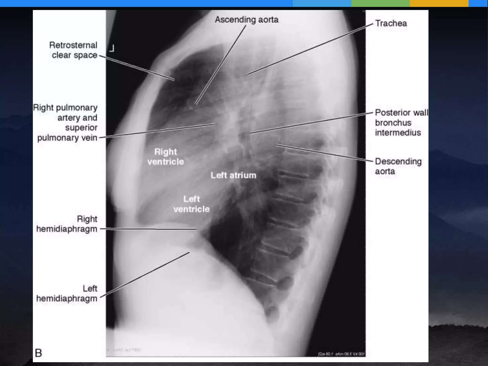 diagnostic workup of the the thoracic surgery patient | PPTX