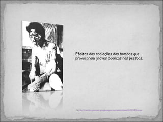 Efeitos das radiações das bombas que provocaram graves doenças nas pessoas.  In, http://marinho.goncalo.googlepages.com/asbombasat%C3%B3micas 