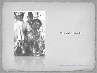In, http://www.tamilnation.org/humanrights/hiroshima.htm Vitima de radiação 