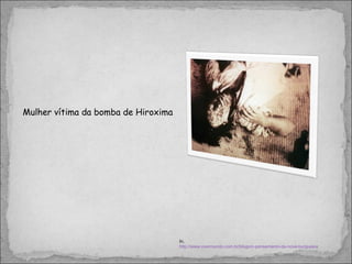 Mulher vítima da bomba de Hiroxima  In,  http://www.overmundo.com.br/blogs/o-pensamento-da-nova-burguesia 