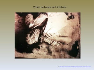 Vitima da bomba de Hiroshima In,  http://www.overmundo.com.br/blogs/o-pensamento-da-nova-burguesia 