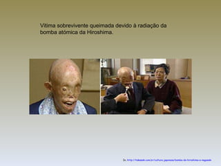 In,  http://takasaki.com.br/cultura-japonesa/bomba-de-hiroshima-e-nagasaki Vitima sobrevivente queimada devido à radiação da bomba atómica da Hiroshima. 