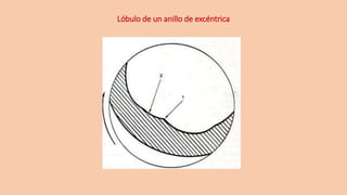 Lóbulo de un anillo de excéntrica
 